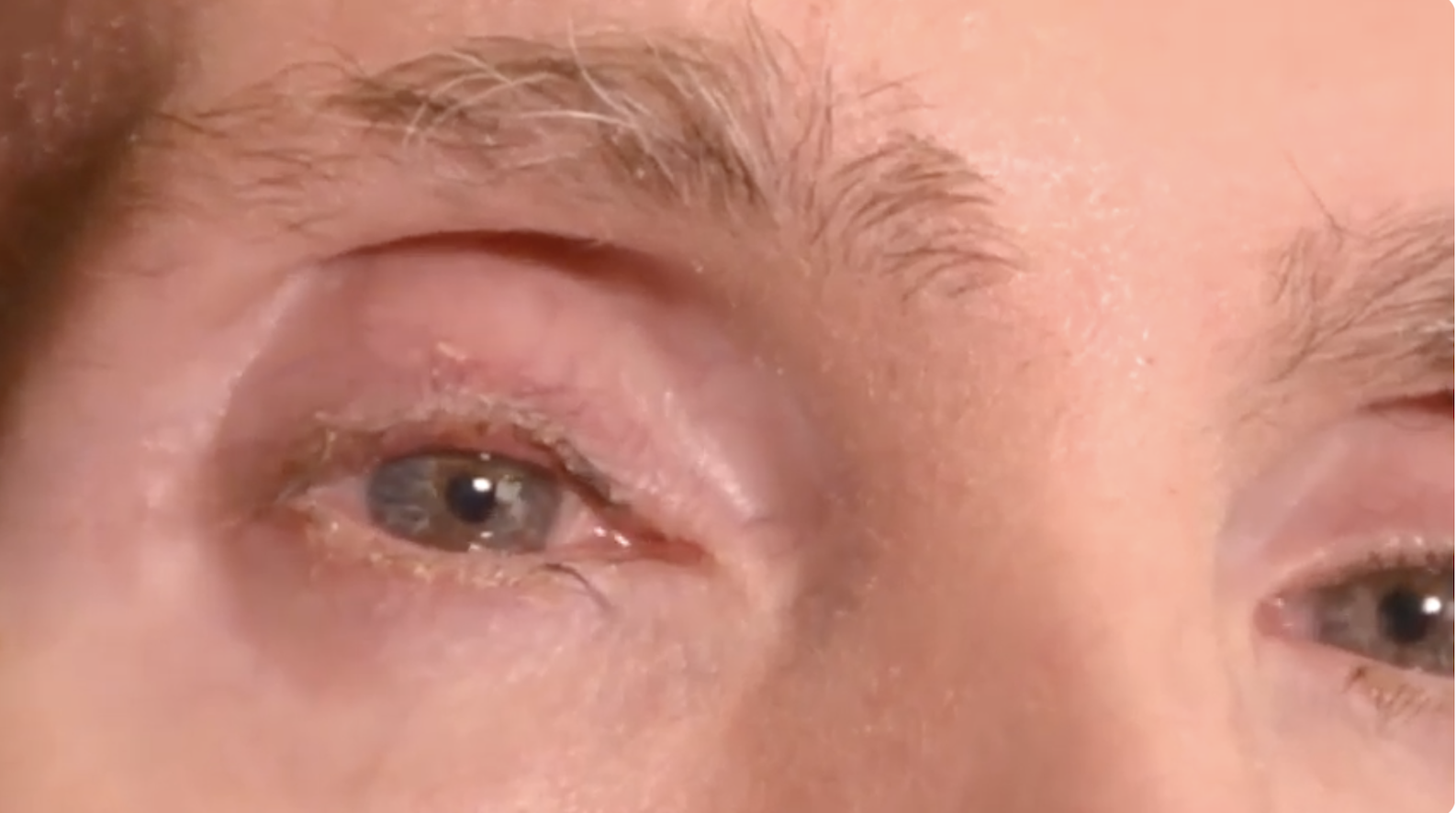 Extreme close-up of DJ HOTSOX's eyes — the documentary explores making music through eyegaze
